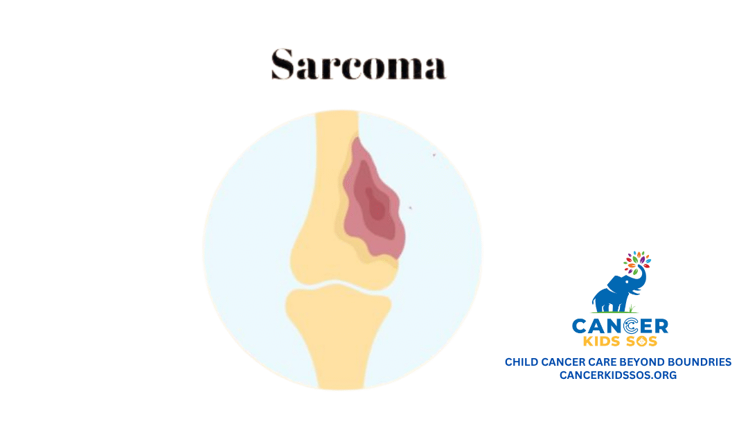 Childhood Sarcomas : Complete Guide to Types, Symptoms, Treatment & Advances