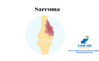 Childhood Sarcomas : Complete Guide to Types, Symptoms, Treatment & Advances